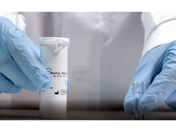 Imagem de Teste Rapido Ag 2019-Ncov